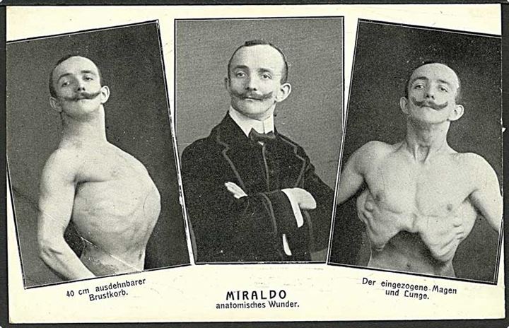Miraldo, anatomisk vidunder. U/no.